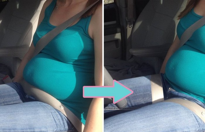 seatbelts and pregnancy